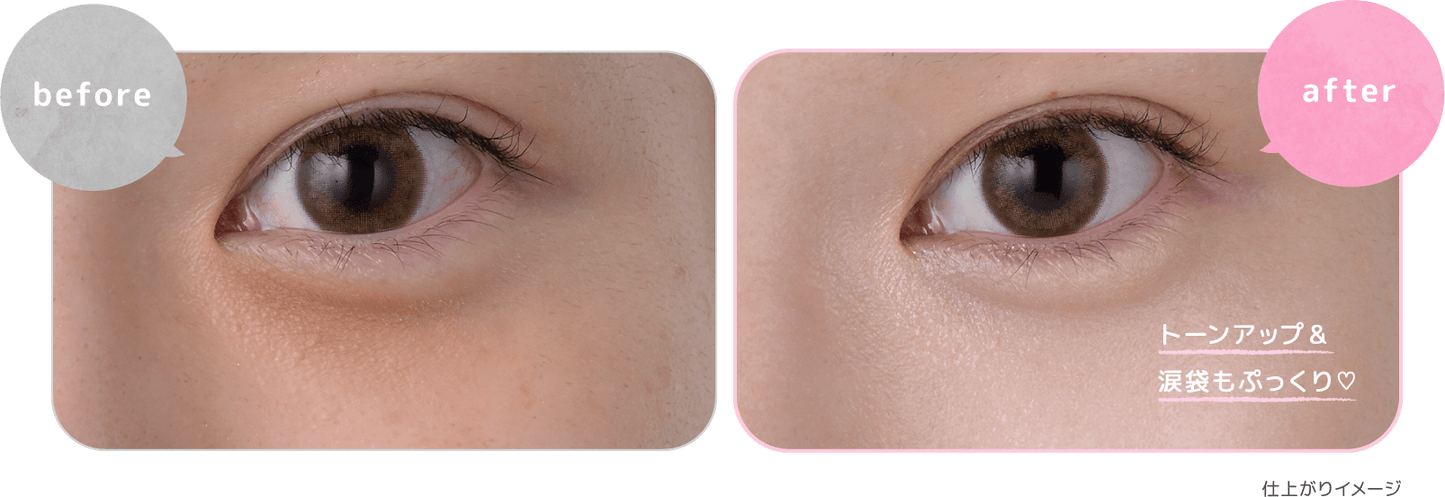 Crème contour des yeux anti-cernes KOSE